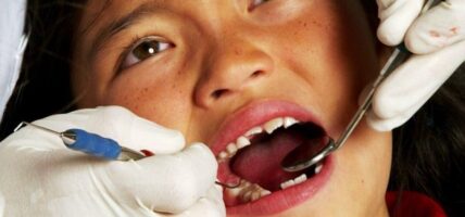 कसरी बच्चाको दाँत राम्रो र बलियो बनाउने ? डाक्टर संबाद